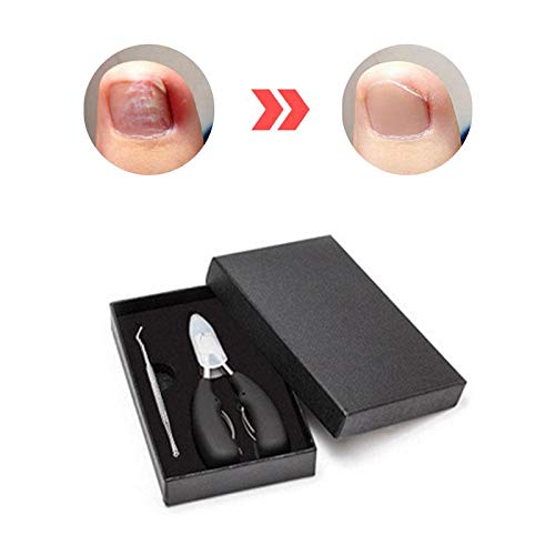 MAYCREATE Toe Nail Clipper for Ingrown or Thick Toenails, Stainless Steel Toenail Clipper, Professional Pedicure Tools Kit with Nail File (2PCS, Black)