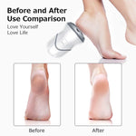MAYCREATE Electric Pedicure Tools for Feet, Foot Scrubber for Dead Skin Remover, Foot File Vacuum Adsorption Callus Remover, USB Rechargeable Foot Care Tool