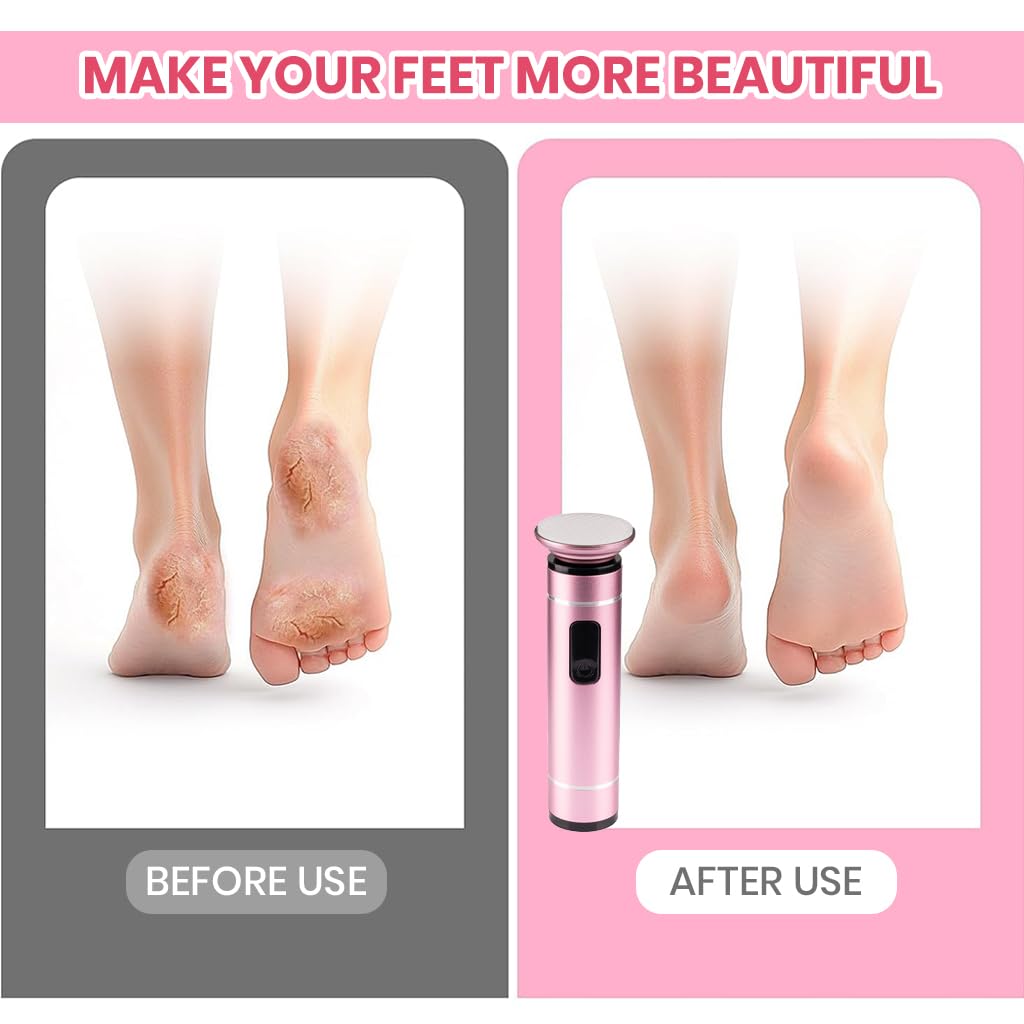 MAYCREATE Electric Foot File for Smooth Feet with 2 Speed Modes and Nano Glass Head | USB Rechargeable 800mAh Pedicure Tool