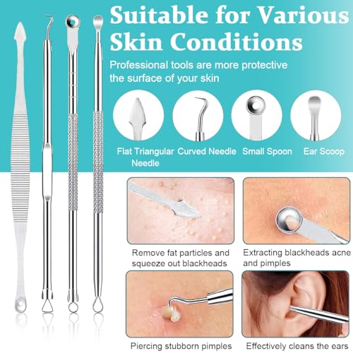 MAYCREATE® Blackhead Remover Tool Kit Pore Cleaning Tools, 15pcs Stainless Steel Blackhead Remover Tool Kit for Pimples, Blackheads, Whiteheads, Zit, Deep Pore Cleaning Tool with Storage Box