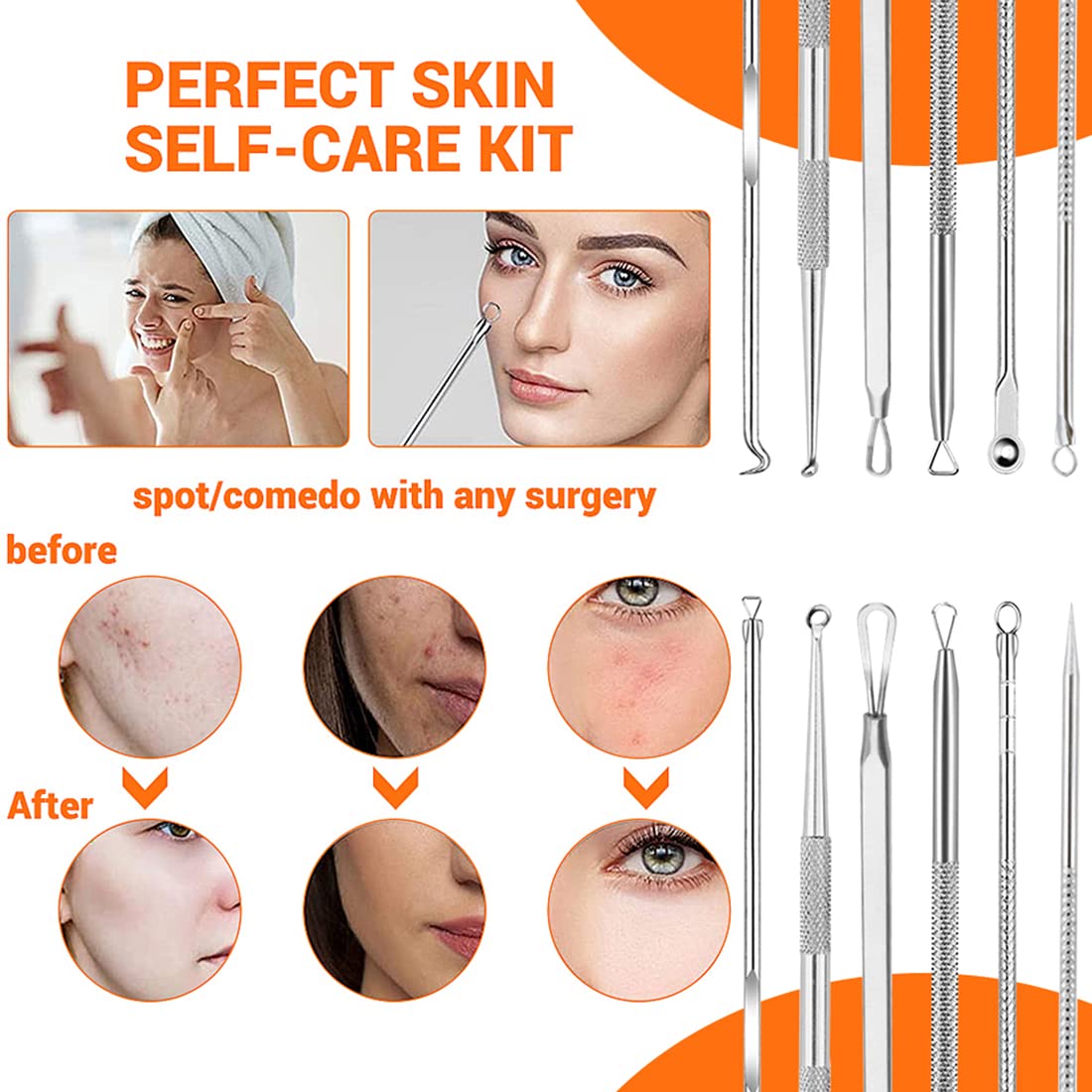 MAYCREATE 9PCS Blackhead Remover Tools Stainless Steel Blackhead Pimple Blemish Extractor/Remover Tool with Tweezers, Professional Acne Remove Tools