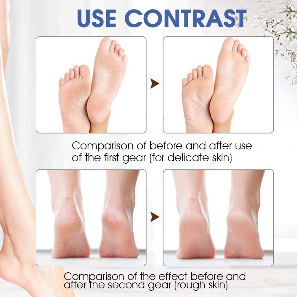 MAYCREATE Electric Callus Remover for Foot Care with 2 Replacement Rollers | Rechargeable Pedicure Tool