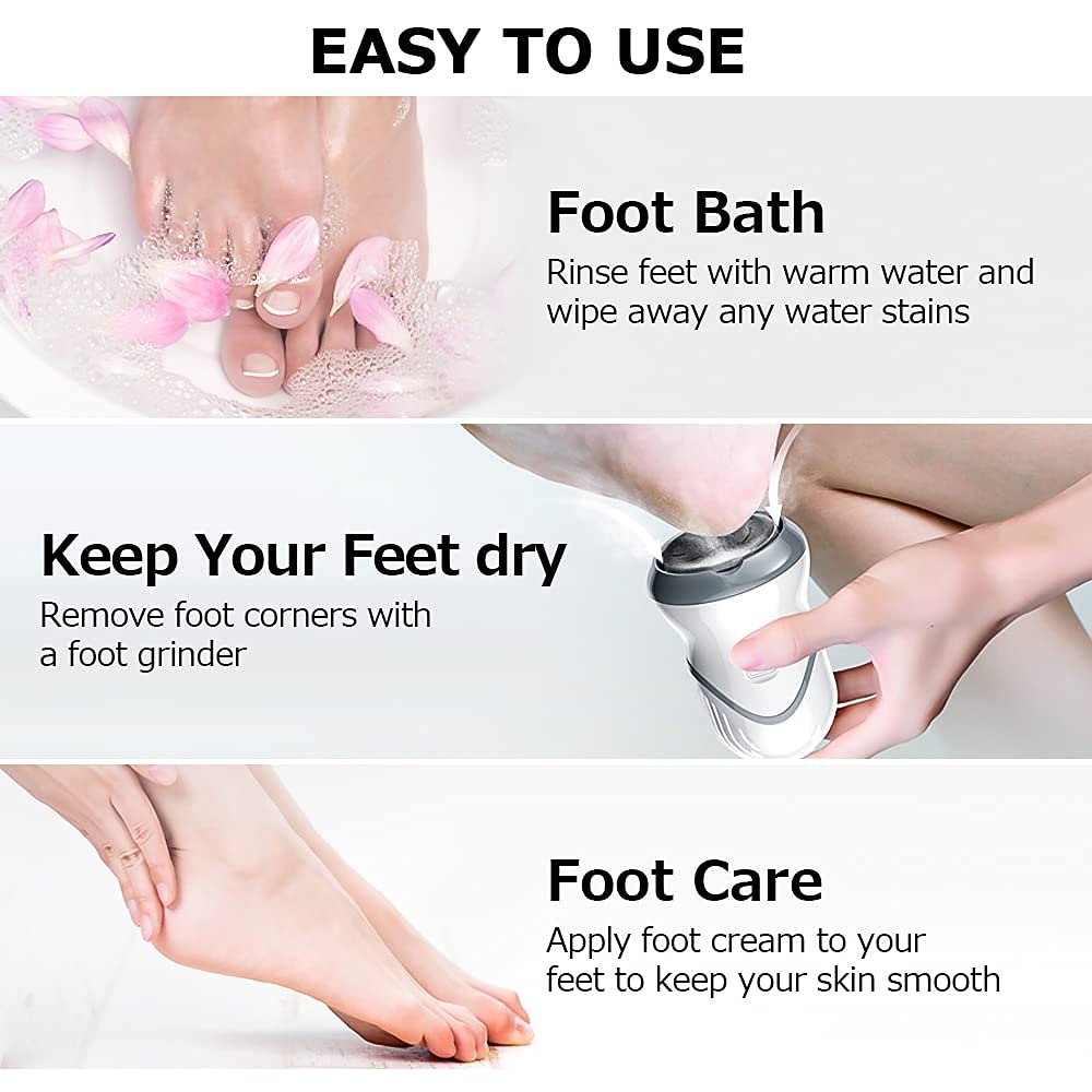 MAYCREATE Callus Remover for Foot Care featuring 2000 rpm Micro Abrasion and Built in Vacuum | USB Rechargeable 500mAh Battery