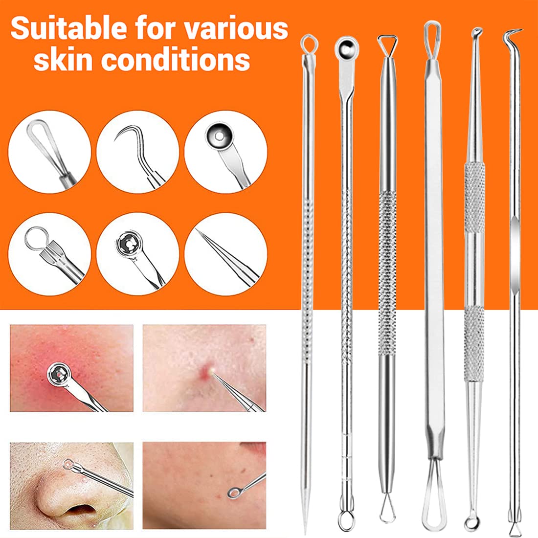 MAYCREATE 9PCS Blackhead Remover Tools Stainless Steel Blackhead Pimple Blemish Extractor/Remover Tool with Tweezers, Professional Acne Remove Tools