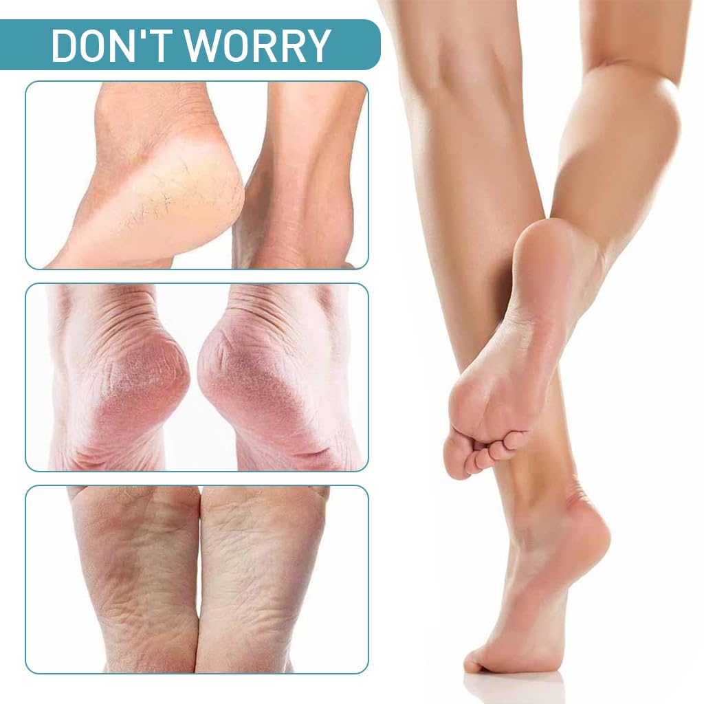 MAYCREATE 5Pcs Pedicure Tool Kit with Case Cuticle Scrapers Tool Pedicure Shavers Cuticle Callus Shavers Remove Dead Skin Stainless Steel Foot Care Tools