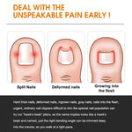 MAYCREATE Ingrown Toenail Clippers for Thick Nails with Curved Blade | 6pcs Stainless Steel Kit