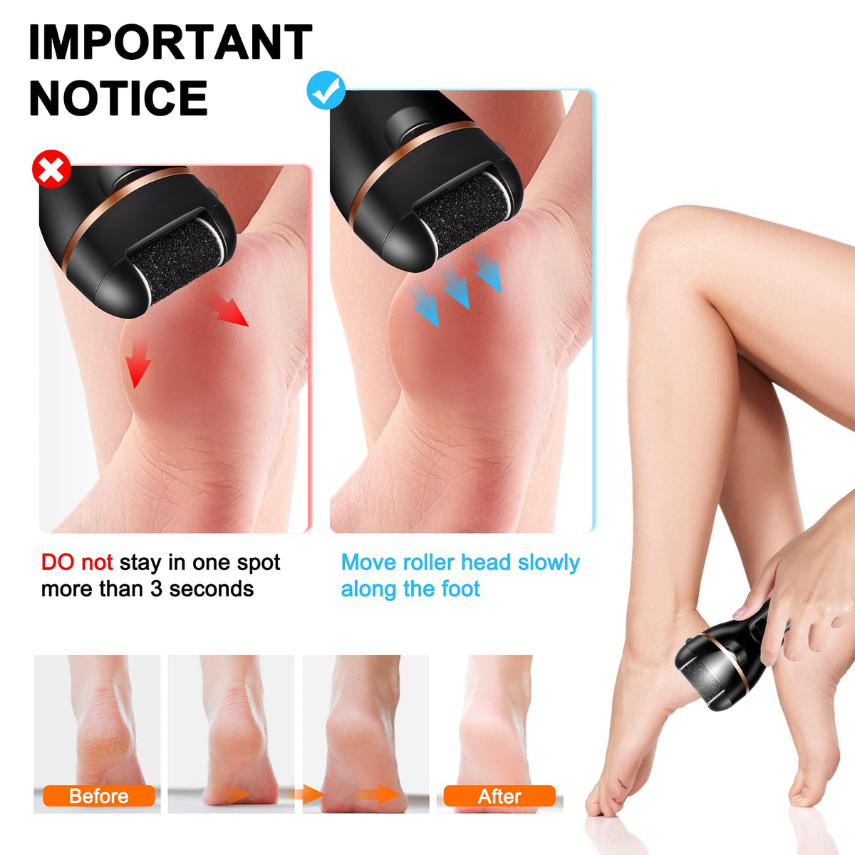 MAYCREATE Rechargeable Electric Callus Remover for Feet 2 Speed, Rechargeable Foot Care, Foot Scrubber For Callus & Dead Skin Removal Electric Pedicure Machine