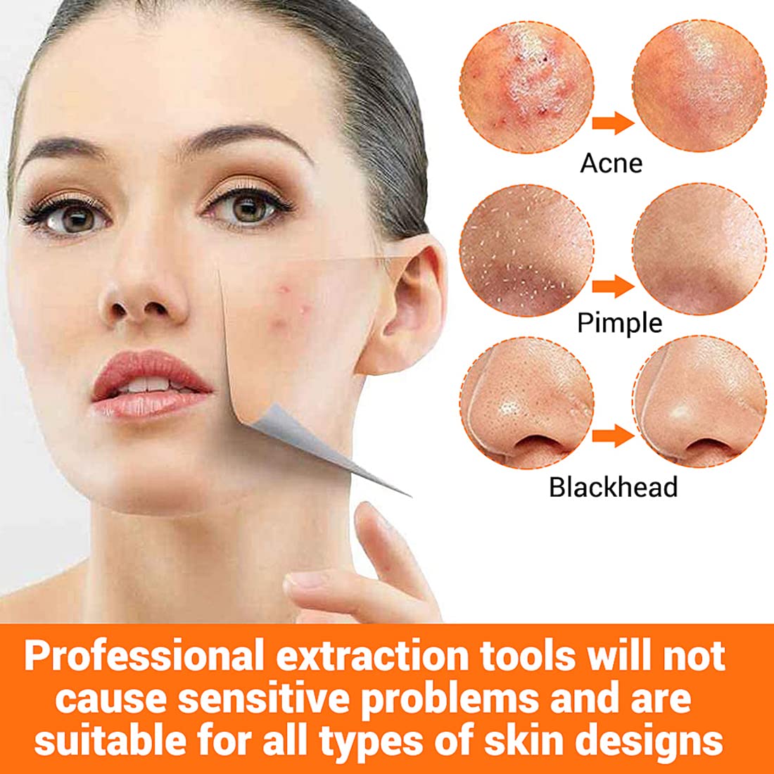 MAYCREATE Blackhead Remover Tools for Acne Care featuring Dual Head Design & Anti Slip Handle | 9PCS Stainless Steel Set