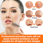 MAYCREATE Blackhead Remover Tools for Acne Care featuring Dual Head Design & Anti Slip Handle | 9PCS Stainless Steel Set
