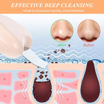 MAYCREATE® Black Head Remover Tool Blackhead Removal Extractor Stainless Steel White Heads Face Scraper Deep Cleansing Comedone Heart-shaped Handle Curved Facial Skin Scrubber 2 PCS