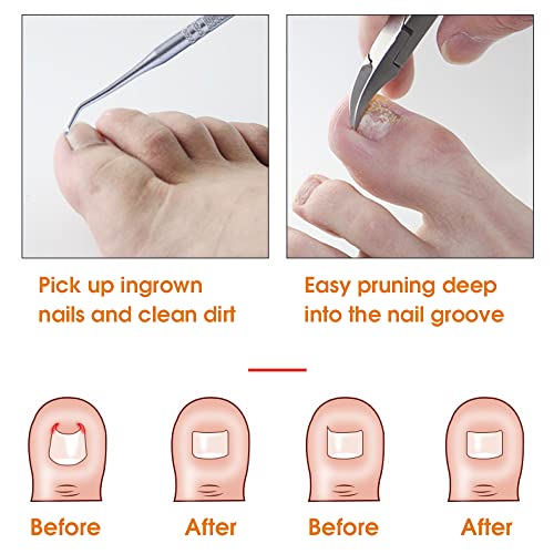MAYCREATE® Ingrown Toenail Clippers for Thick Toenails Wide Jaw Opening Nail Curved and Slant Straight Blade Edge 12PCS Stainless Steel Toe Clipper Men