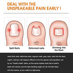 MAYCREATE® Ingrown Toenail Clippers for Thick Toenails Wide Jaw Opening Nail Curved and Slant Straight Blade Edge 12PCS Stainless Steel Toe Clipper Men