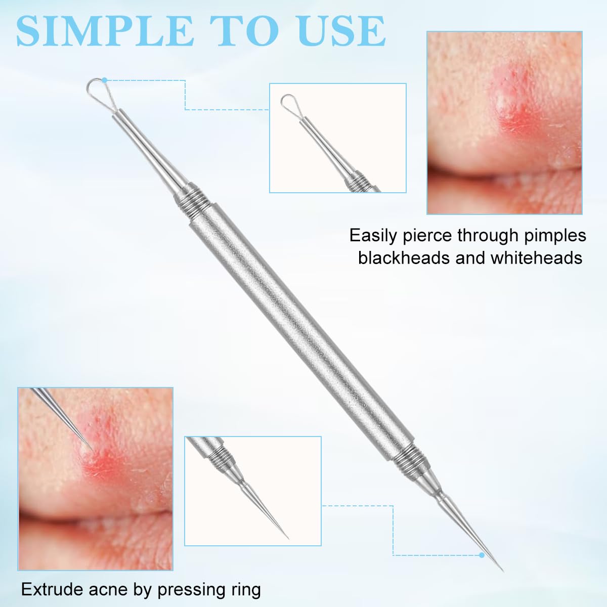 MAYCREATE Dual Head Blackhead Remover Tool for Safe Comedone Extraction with Stainless Steel | Includes Needle and Loop with Protective Caps