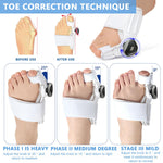 MAYCREATE Bunion Thumb Corrector for Left and Right Foot with Adjustable Rotating Knob | Toe Separator for Men and Women