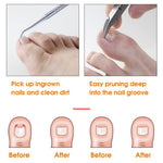 MAYCREATE Ingrown Toenail Correction Tool for Thick Nails with Curved Blade & Ergonomic Handle | Stainless Steel Clippers Set with 4 Nail Care Tools and Storage Case
