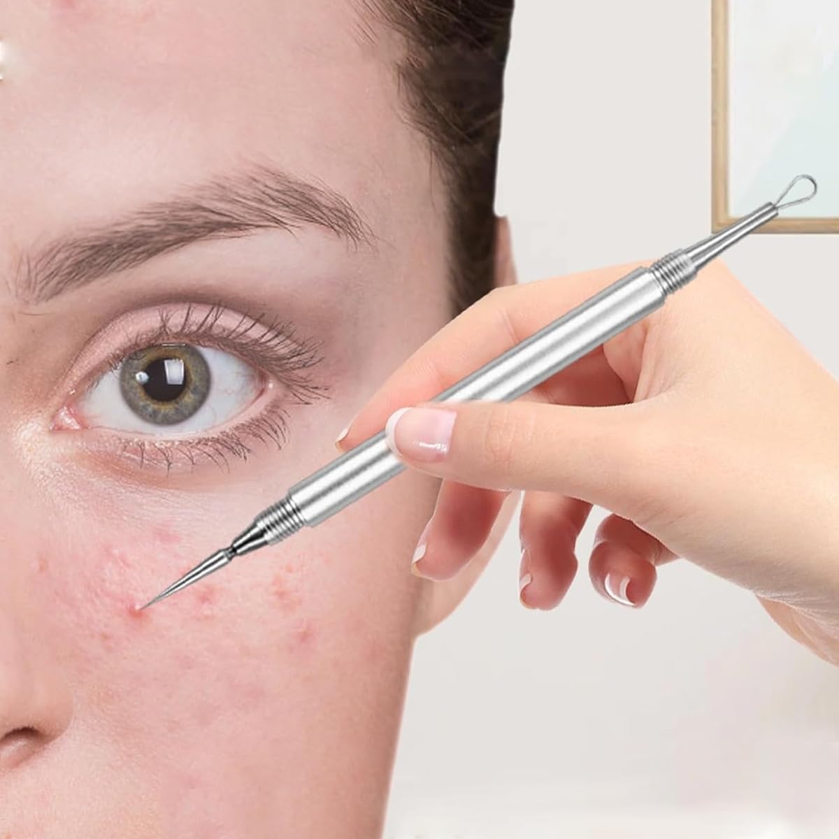 MAYCREATE Dual Head Blackhead Remover Tool for Safe Comedone Extraction with Stainless Steel | Includes Needle and Loop with Protective Caps