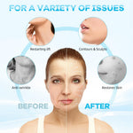MAYCREATE Double Chin Reducer for 30 Minute Daily Use featuring Adjustable Jawline Lifting Strap | Firming Mask for Sleeping and Facial Sculpting