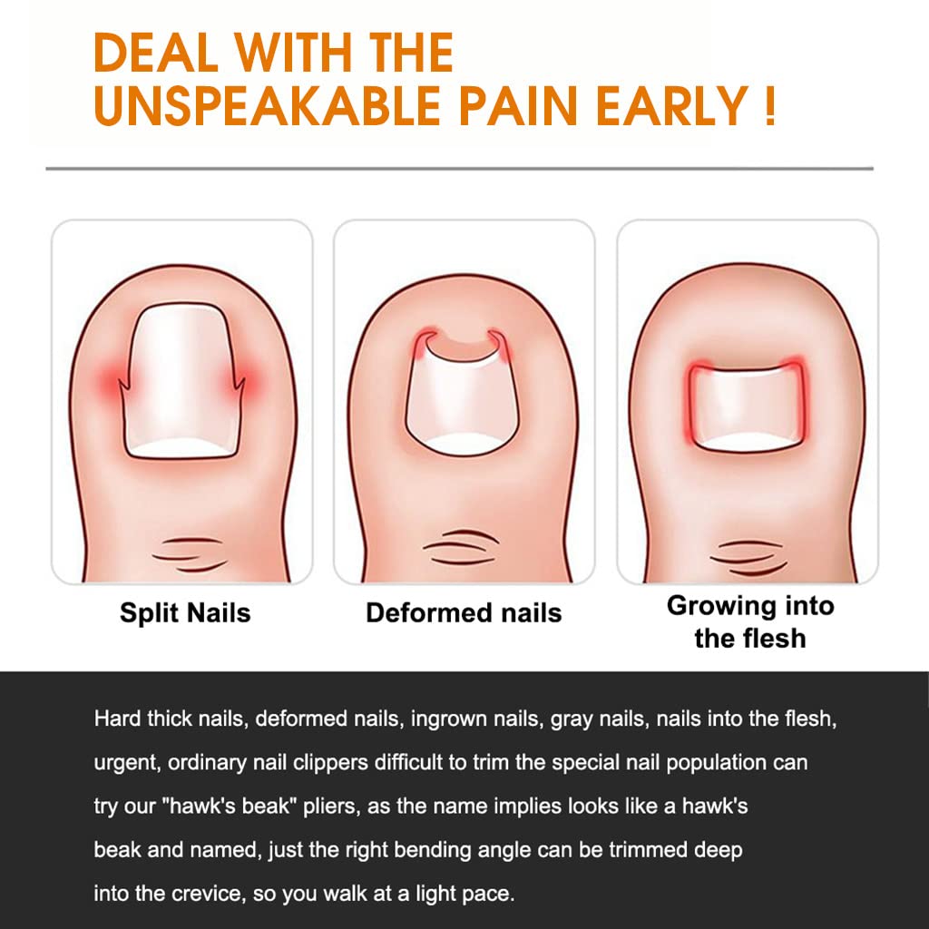 MAYCREATE Ingrown Toenail Clippers for Thick Nails with Curved Blade and 6pcs Stainless Steel Kit | Ergonomic Wide Jaw Design