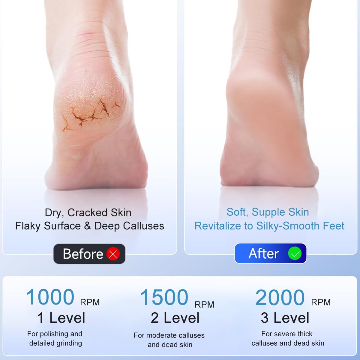 MAYCREATE Electric Foot Callus Remover for Pedicure Care with 3 Speeds and Pressure Sensor | USB Rechargeable Stainless Steel Tool