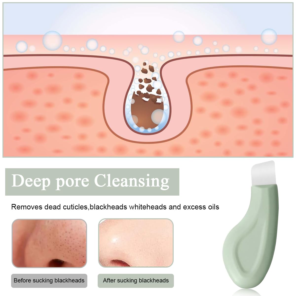 MAYCREATE Blackhead Removal Tool for Deep Facial Cleansing with Stainless Steel Scraper | Silicone Handle for Men and Women